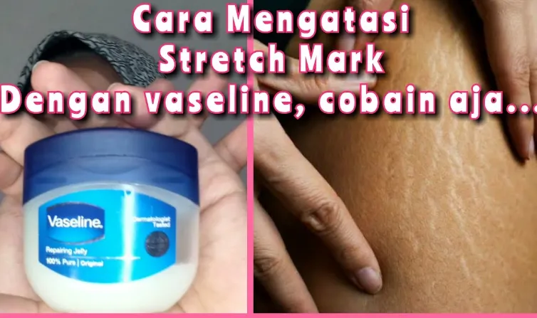 Metode Ampuh Menghilangkan Stretch Mark dengan Vaseline